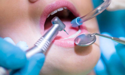 Post Operative Dental Instruction in Warner Robins GA